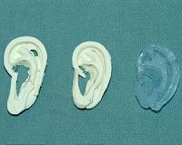 3-D printing techniques help surgeons carve new ears
