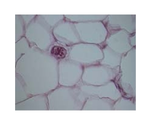 Putting The Squeeze On Fat Cells