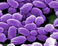 21 infected in far north Russia anthrax outbreak
