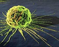 1.7 million-year-old foot bone offers earliest evidence of malignant cancer
