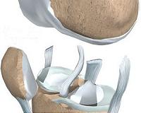 3D printer could soon make cartilage for knees, noses, ears
