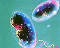 Cholera epidemic spreads in Guinea-Bissau, stable in Guinea: WHO