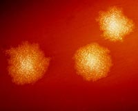 Revealed: Chinks in superbug's armour