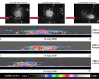 CloudSat Captures Hurricane Daniel's Transformation