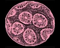 A world free from cancers: Probable, possible, or preposterous?