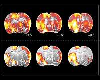 How dopamine drives brain activity