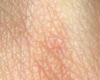 Photoaging could reverse negative impact of ultraviolet radiation