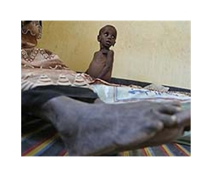 Malnutrition taking its toll on Somali children