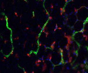 Researchers step closer to custom-building new blood vessels
