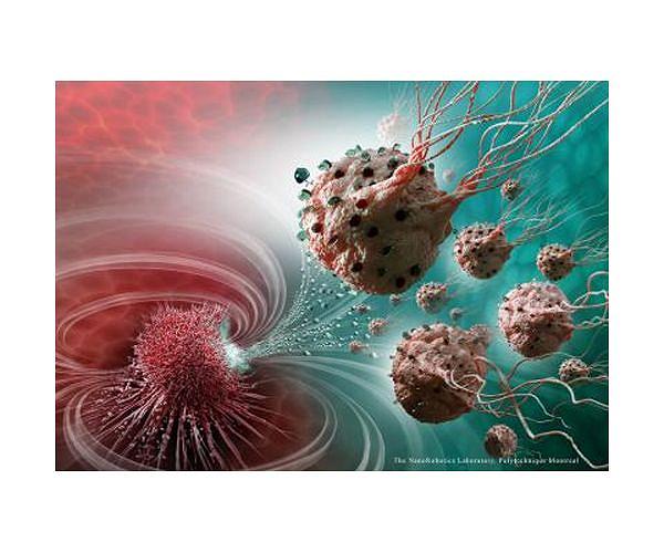 Electronic nose successfully detects elusive cancers