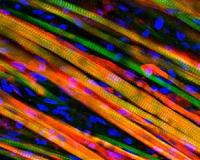 Self-healing engineered muscle grown in the laboratory