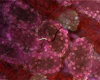 US fast-tracking antimalarials to treat coronavirus: Trump
