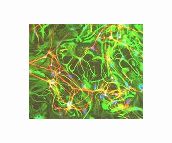 3D-printed bioreactor allows scientists to watch tiny brains grow