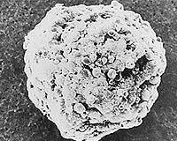 Lung-Cancer Gene Signature Discovered