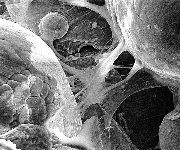 Researchers 3D print biomedical parts with supersonic speed