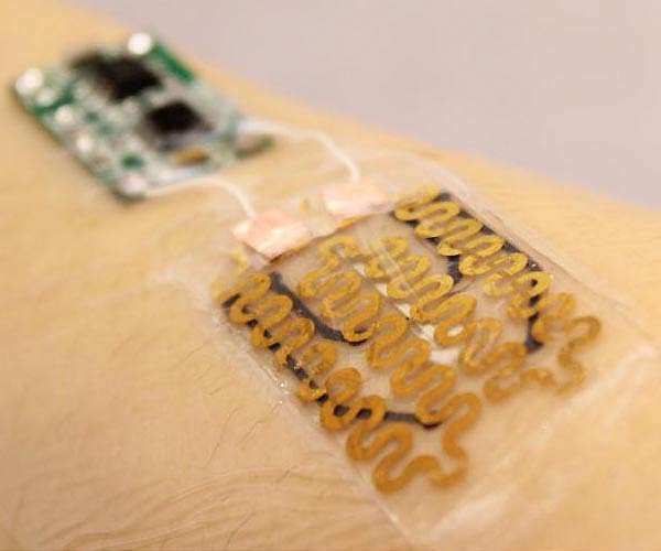 'Smart bandage' could monitor wound healing, researchers say
