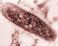 Earliest Known Human TB Found In 9,000 Year-Old Skeletons