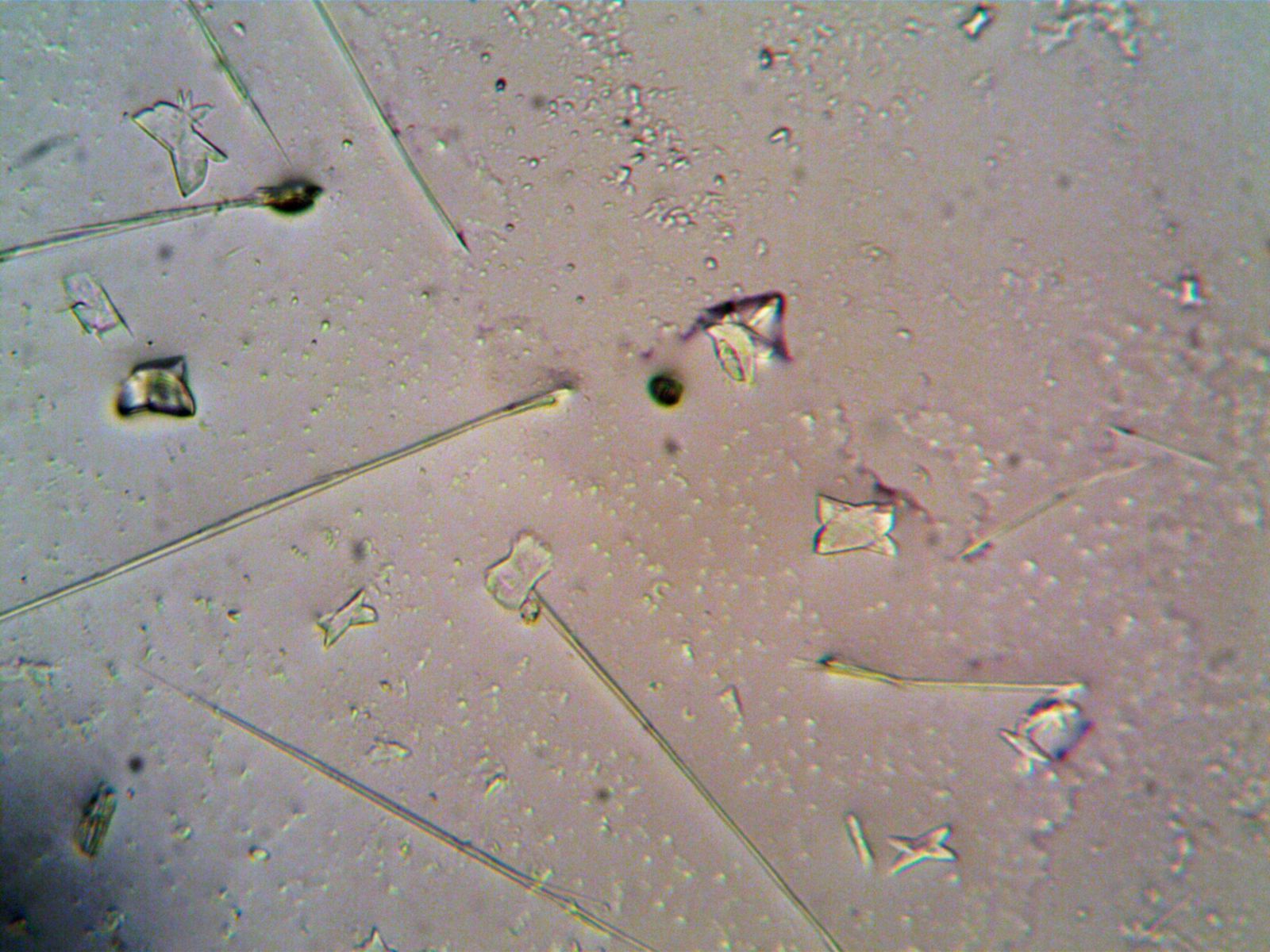 bacteriophage electron micrograph
